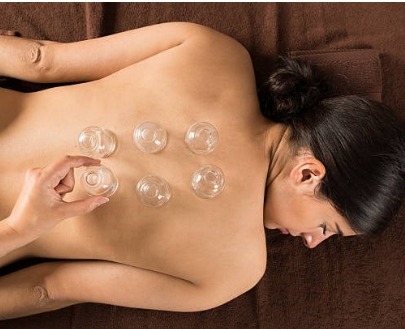 Cupping Therapy